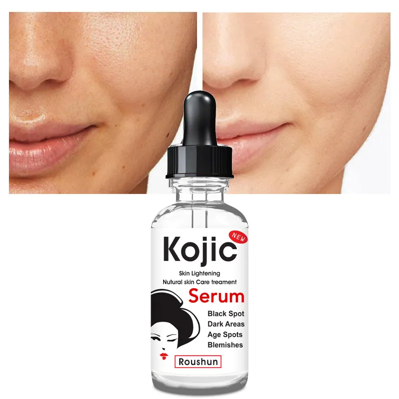 Roushun Kojic Skin Lightening Serum (30ml) - Image 4
