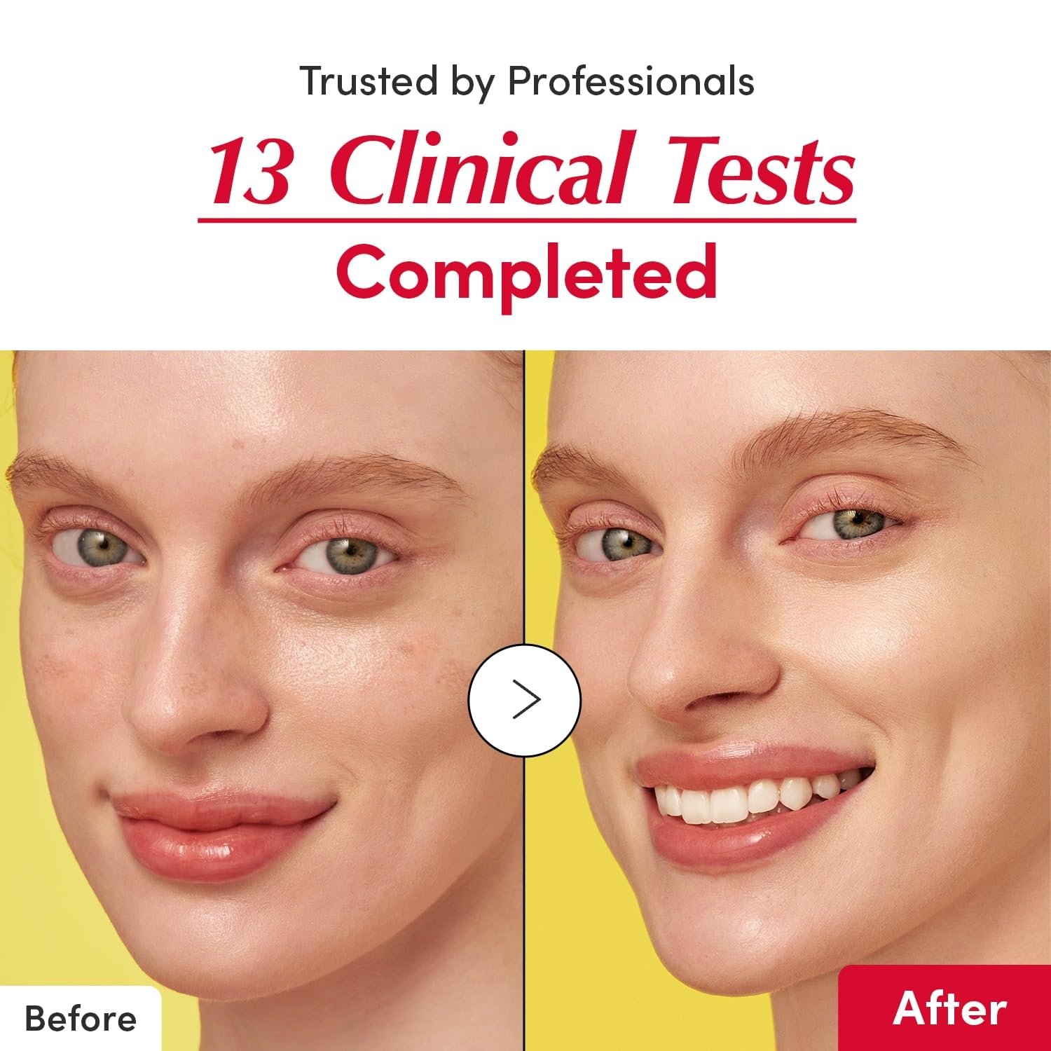 EQQUAL BERRY Vitamin Illuminating Serum-(30ml) - Image 4