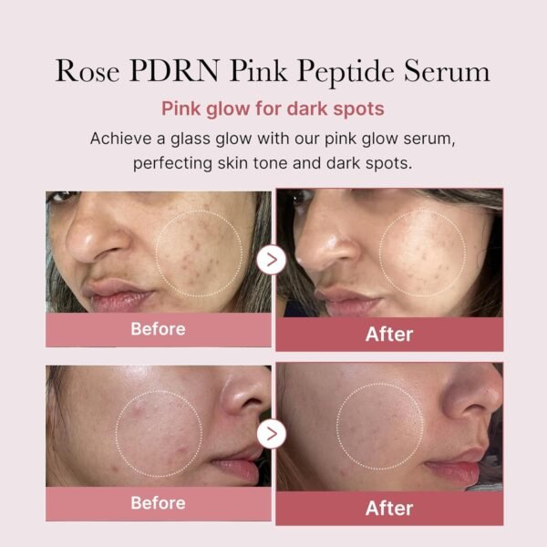 Medicube PDRN Pink Peptide Serum-(30ml) - Image 5