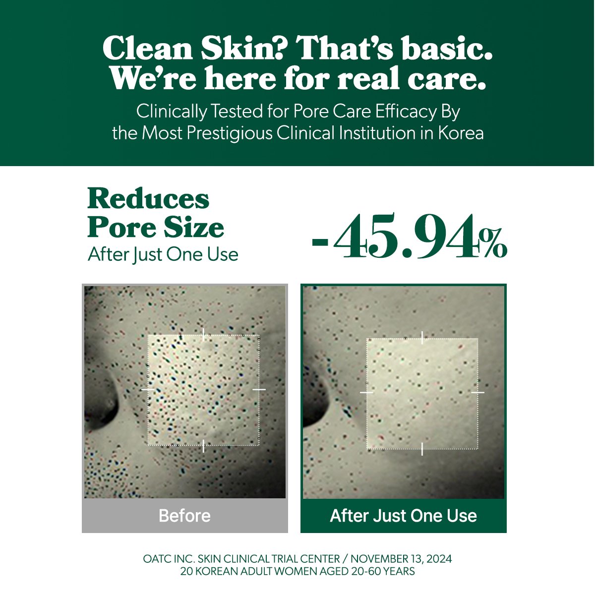 Omitted Fresh Lime Dewy & Pore Purifying Toner Pad (160ml),70Pads - Image 3