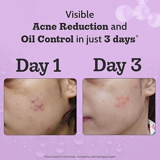 Chemist At Play 2% Salicylic Acid Face Serum (30ml) - Image 5