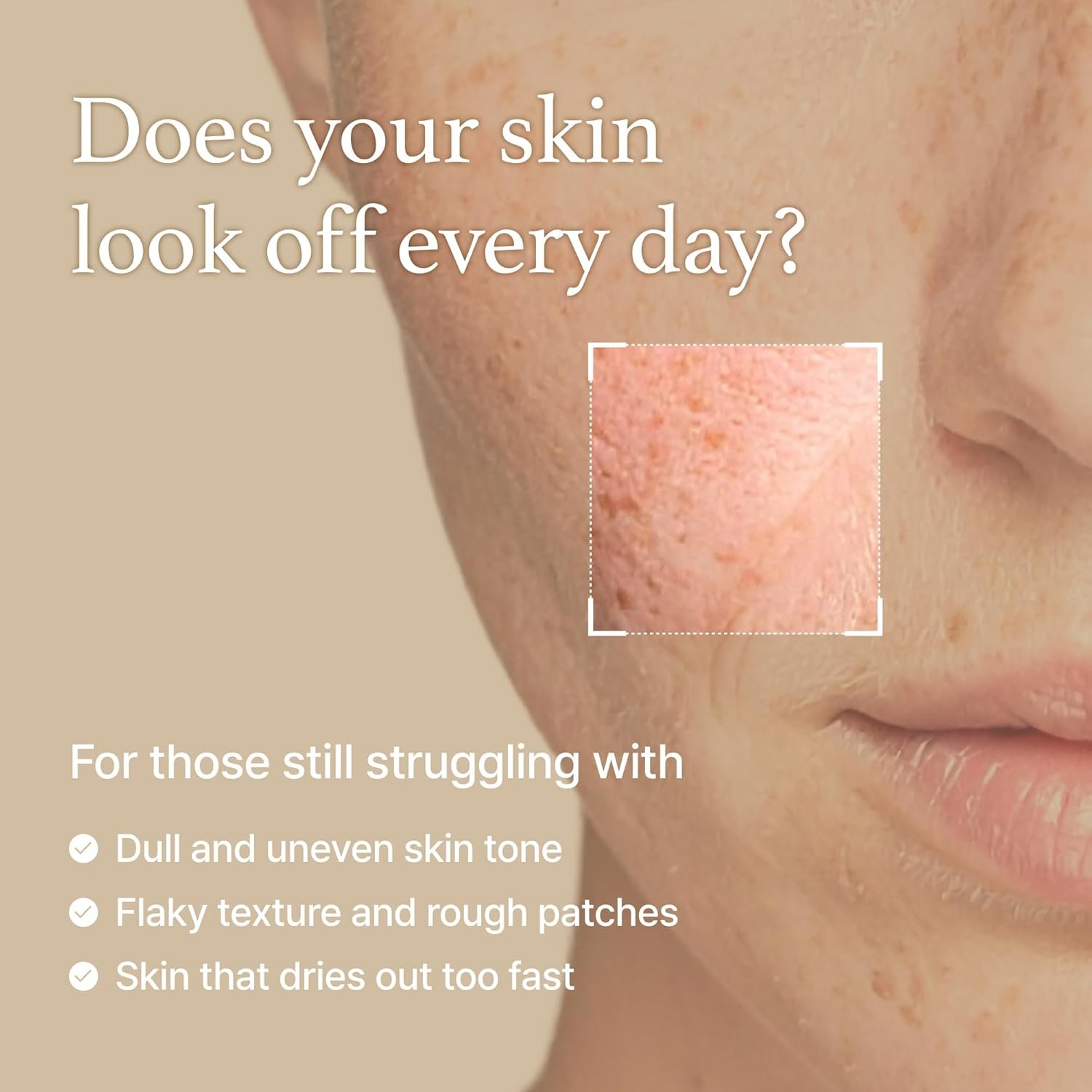 I'm from Rice Toner (150ml) - Image 8