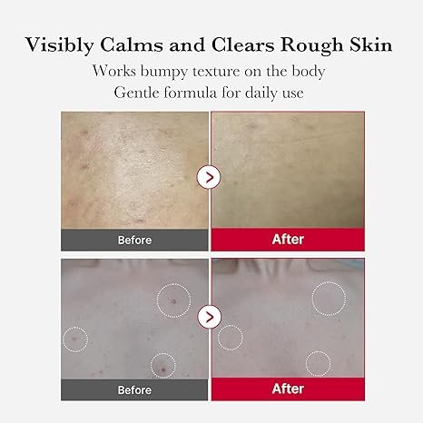 Medicube Red Body Peeling Shot (110ml) - Image 5