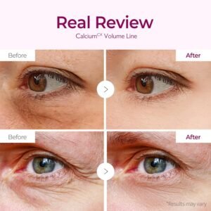 Dr.Melaxin Calcium Volume Under Eye Patches