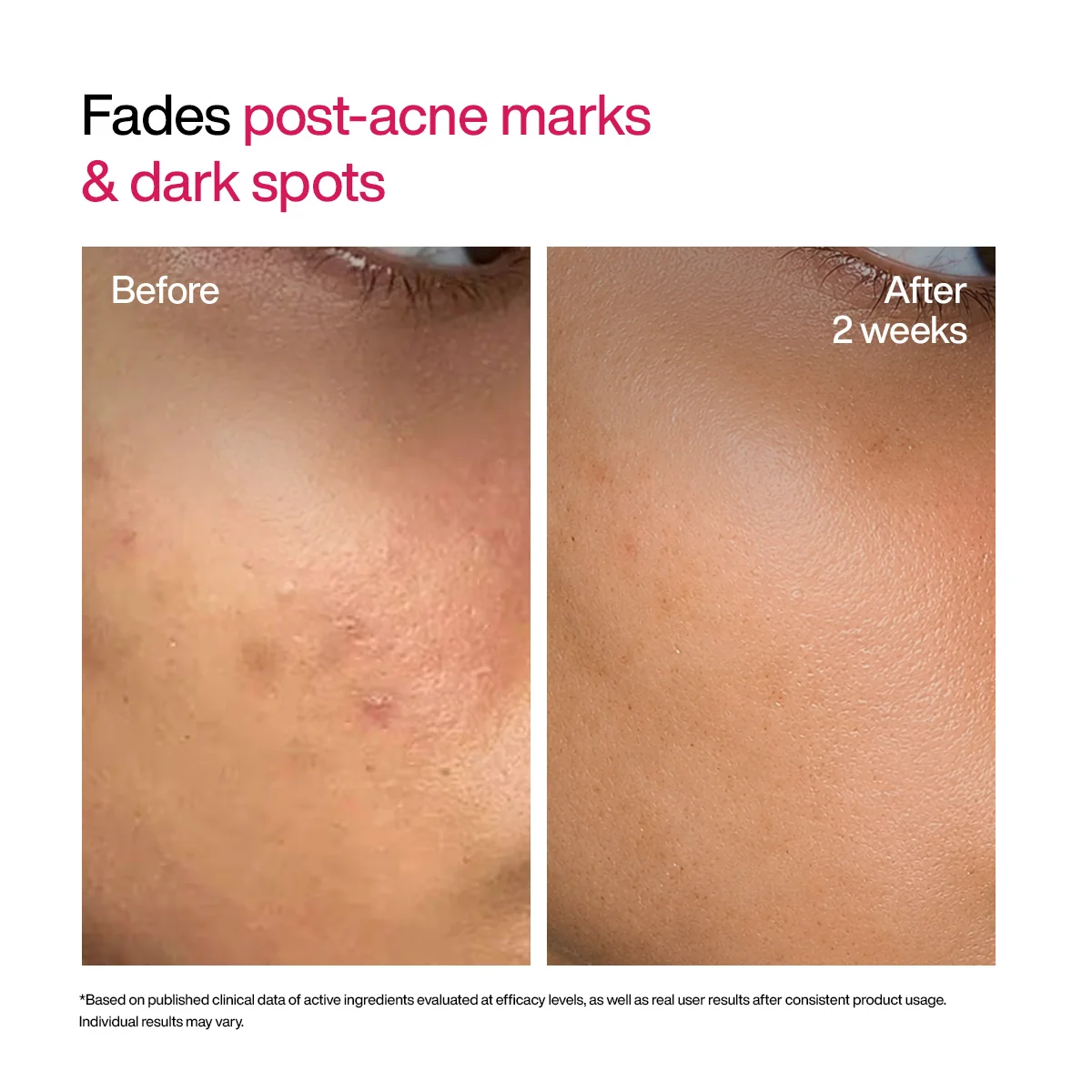 Wishcare Advanced Dark Spot Correcting TXA Shot-30ml - Image 8