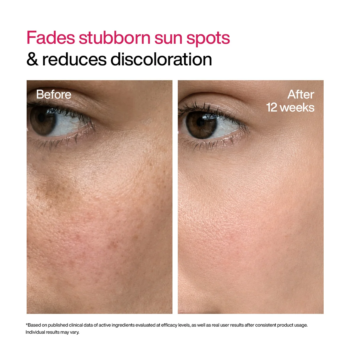 Wishcare Advanced Dark Spot Correcting TXA Shot-30ml - Image 6