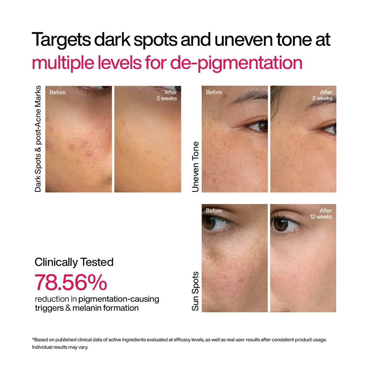 Wishcare Advanced Dark Spot Correcting TXA Shot-30ml - Image 5
