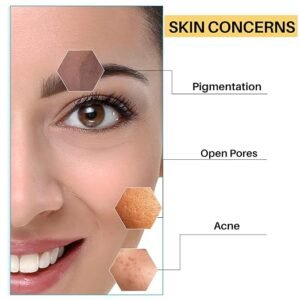 DermDoc 4% Niacinamide Face Cream-50g